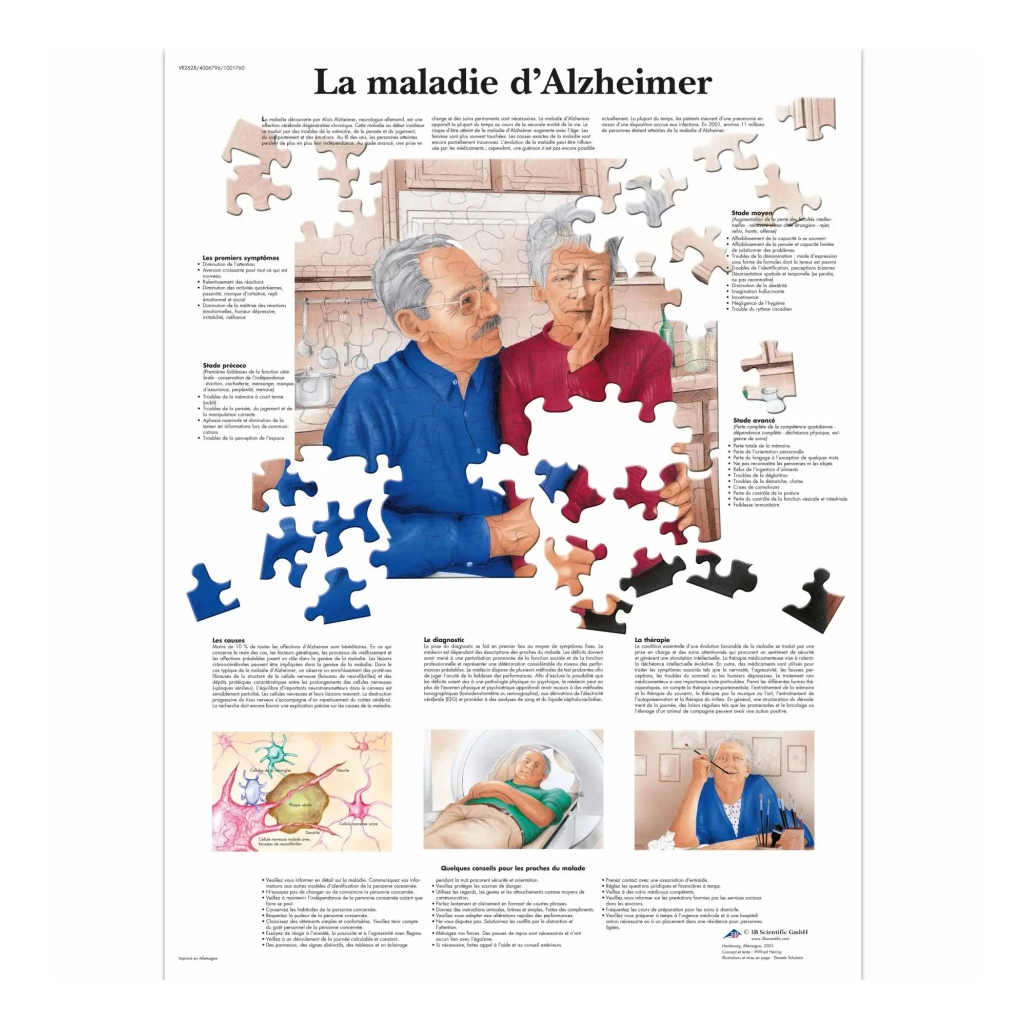 Planche anatomique - La maladie d'Alzheimer - Anatomie et pathologie